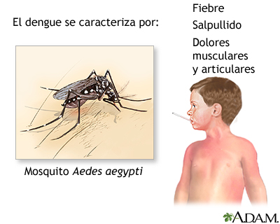 Alerta epidemiológica en Manabí, Santo Domingo de los Tsáchilas y Esmeraldas por intensificación de casos de dengue